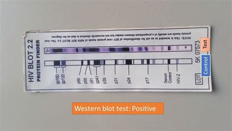 positive western blot test